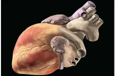 Umělá inteligence dokáže předpovědět infarkt až deset let dopředu